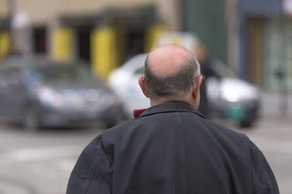 Quelles sont les différentes techniques de greffe pour les cheveux ?