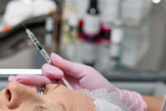 Résultats naturels d'un lifting du visage à Paris